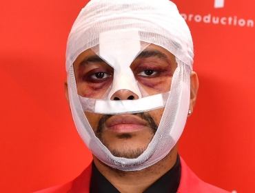 The Weeknd объяснил, что означают его бутафорские шрамы и окровавленные бинты на лице