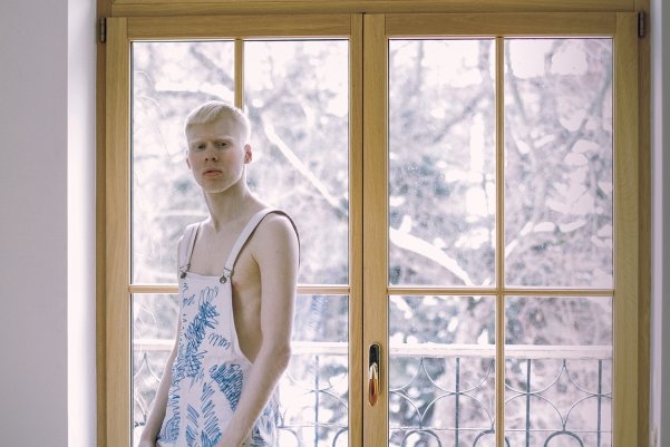 Артем Пивоваров презентовал новый клип «Кислород» о людях-альбиносах