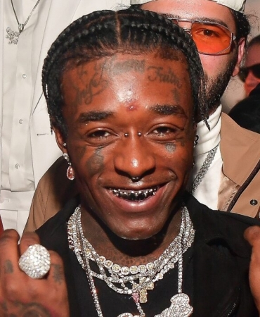 Красотка — это боль: Рэпер Lil Uzi удалил изо лба бриллиант за 24 миллиона долларов