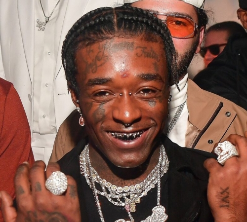 Красотка — это боль: Рэпер Lil Uzi удалил изо лба бриллиант за 24 миллиона долларов